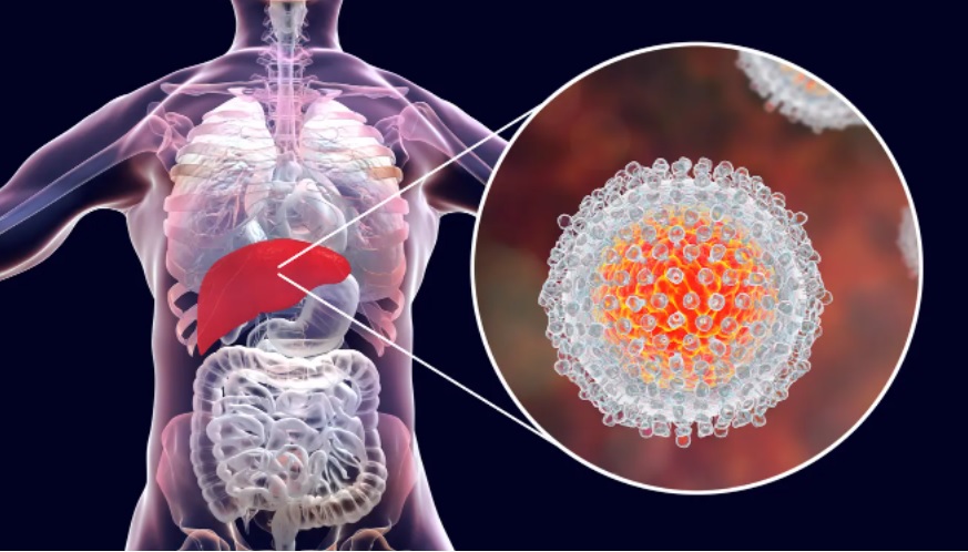 الصحة العالمية: هذه أعراض الالتهاب الكبدي الغامض المكتشفة