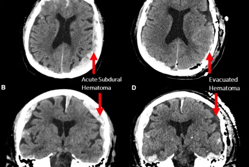 علماء يكتشفون ما يحدث في دماغ الشخص وقت احتضاره: “يرى&nbsp;(…)