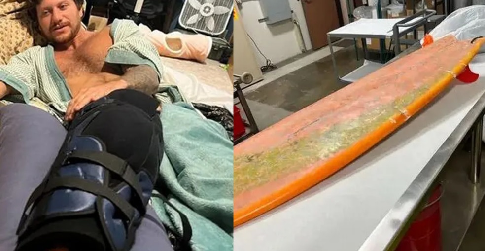 راكب أمواج يروي كيف نجا من فكي قرش عملاق(تفاصيل القصة وصورة)