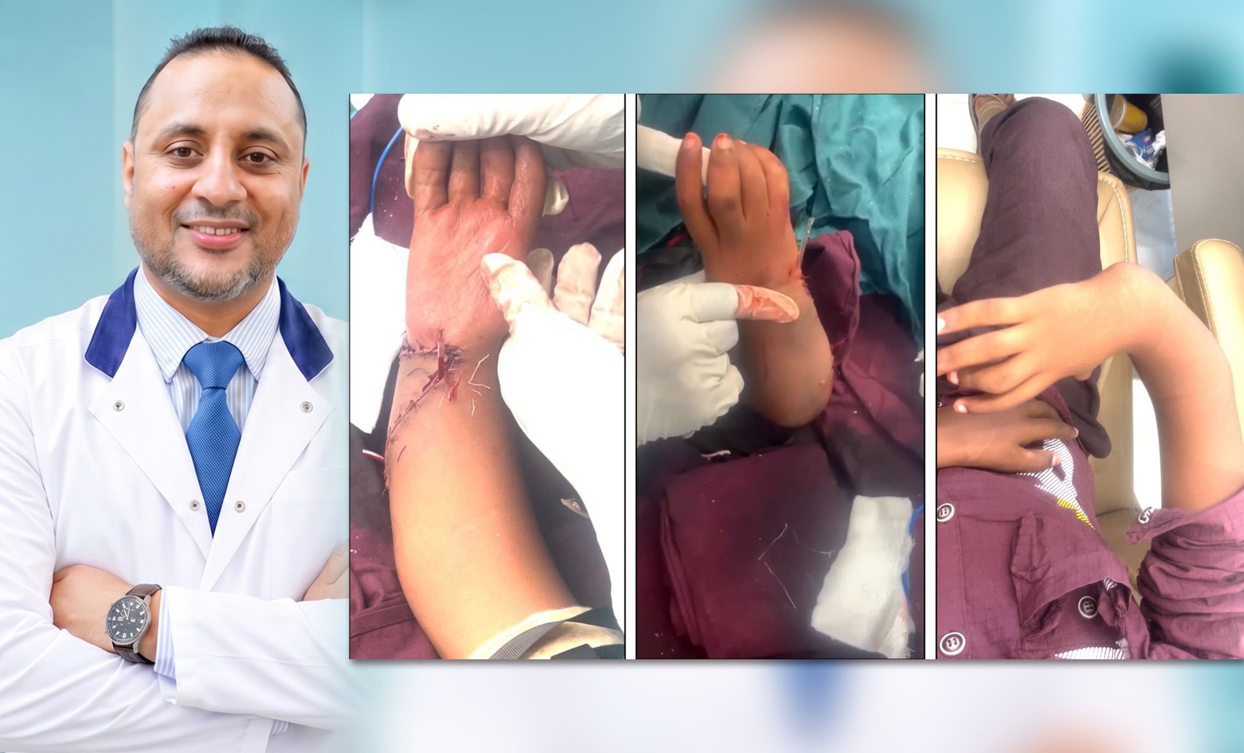 جراح يمني ينهي معاناة طفل من تشوه خلقي معقد بعد 13 عاماً&nbsp;(…)