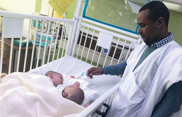 والد التوأمين المتلاصقين يتحدث عن العملية الجراحية المعقدة