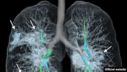 لو كنت رئيسا.. الآن فهمنا خطورة كورونا