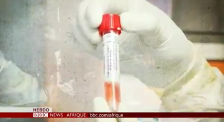 معهد باستير في دكار يعمل على حماية القارة من كورونا