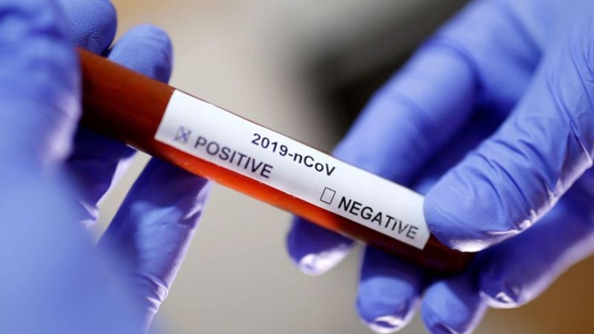 عاجل: السنغال تعلن عن اصابة اول موريتاني بفيروس كورونا&nbsp;(…)