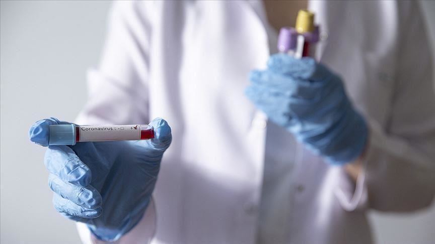 خطة مستعجلة لمواجهة أزمة جائحة فيروس كورونا في موريتانيا