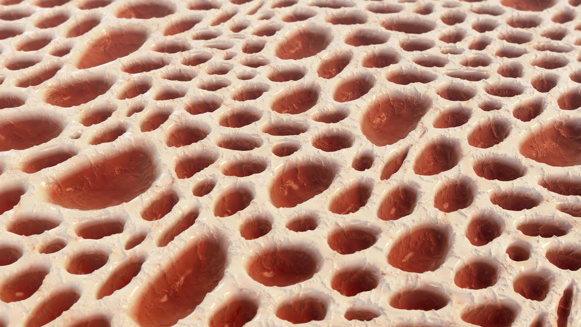 دراسة: نخاع عظم المتعافين فقط يحمل الفرج