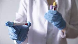 وزارة الصحة: سجلنا اليوم 2 حالة وفاة و281 إصابة جديدة&nbsp;(…)